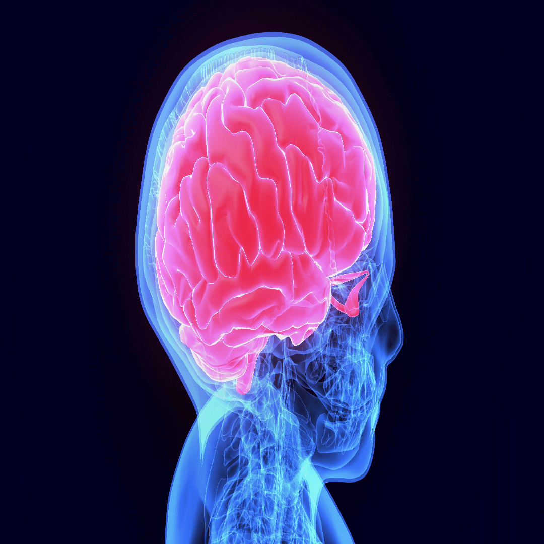 brain-tumor