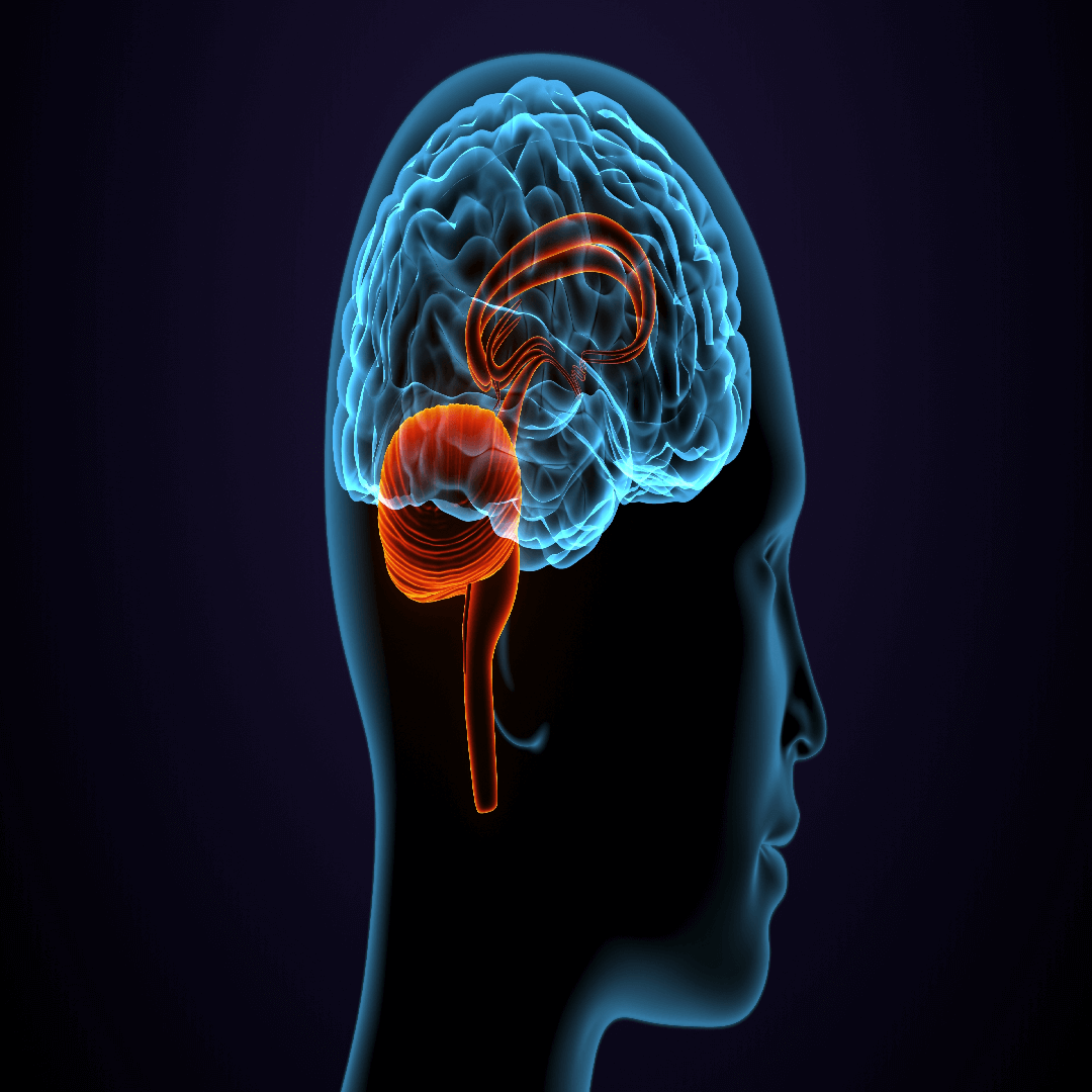 brain-tumor