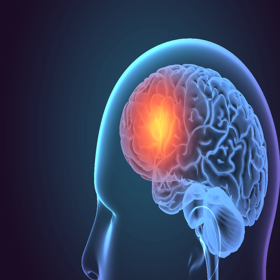 brain-tumor