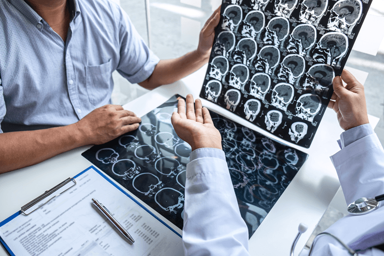 how-does-the-location-of-a-brain-tumour-affect-its-symptoms