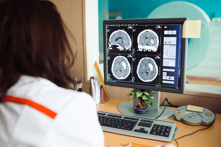 What is the Difference Between Primary and Secondary Brain Tumours?